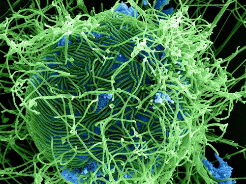 Image: Ebola magnified